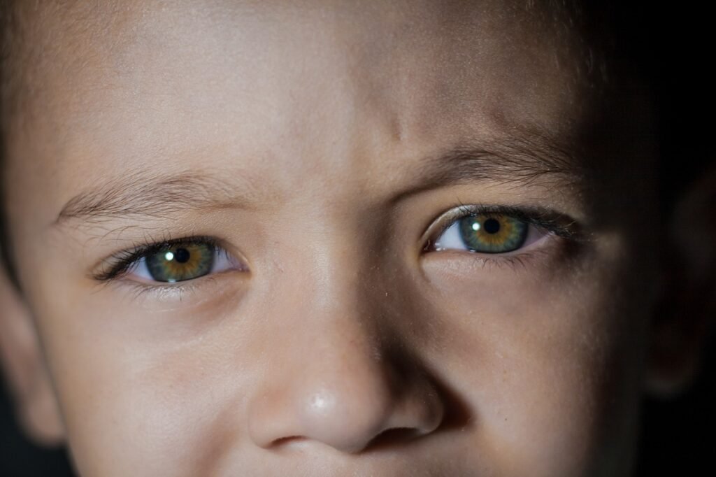 lazy eye, amblyopia