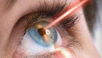 eye Specialists